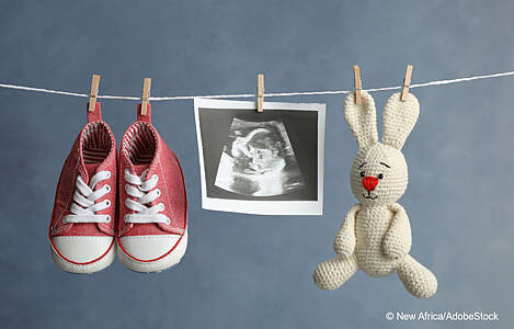 Babyschuhe, Ultraschallbild und Stofftier. Foto: New Africa/AdobeStock.