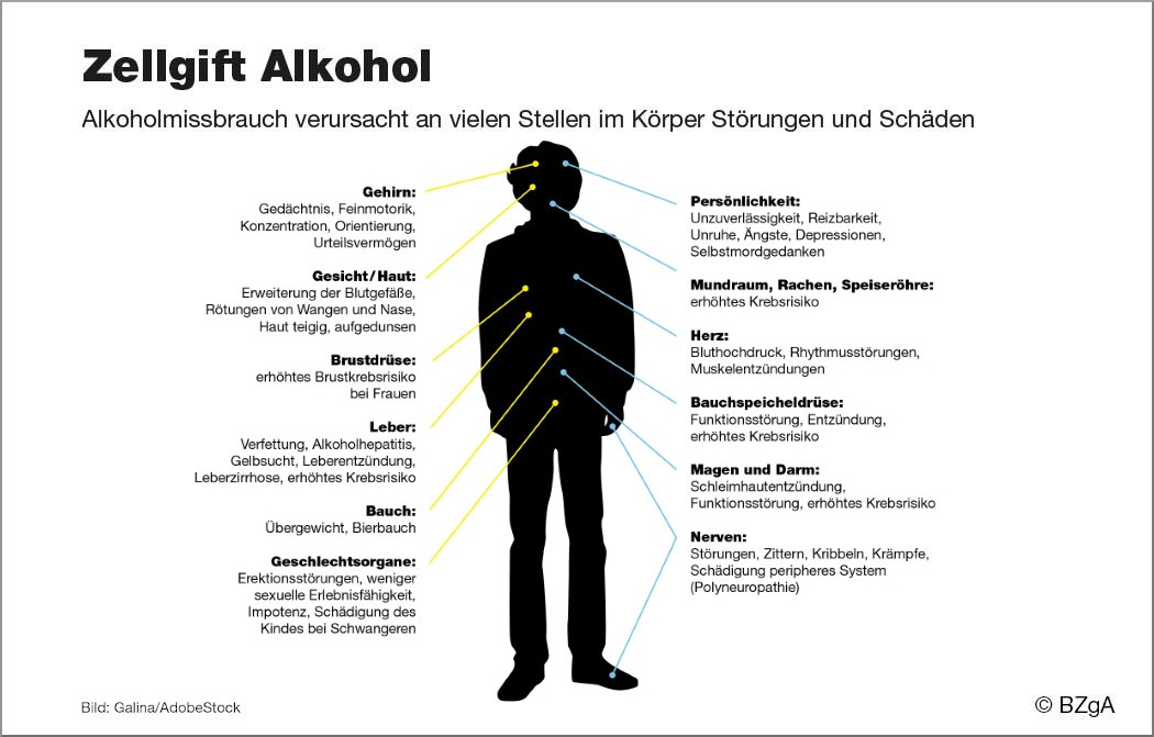 Männer häufiger im Rausch als Frauen - Zellgift Alkohol - Folgen des  Konsums 